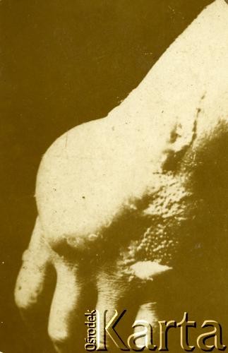Lata 20., brak miejsca.
Poparzenia chemiczne na ręce.
Fot. z albumu porucznika Jana Obłoczyńskiego z Batalionu Chemicznego WP, zbiory Ośrodka KARTA, przekazała Jolanta Wolszczynin.