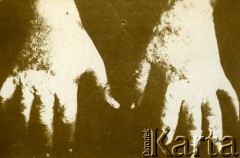Lata 20., brak miejsca.
Poparzenia chemiczne na rękach.
Fot. z albumu porucznika Jana Obłoczyńskiego z Batalionu Chemicznego WP, zbiory Ośrodka KARTA, przekazała Jolanta Woszczynin